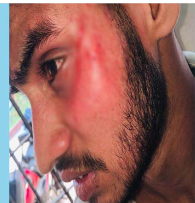 বোনের সঙ্গে প্রেম করায় কলেজছাত্রকে পেটালেন ছাত্রলীগ নেতা