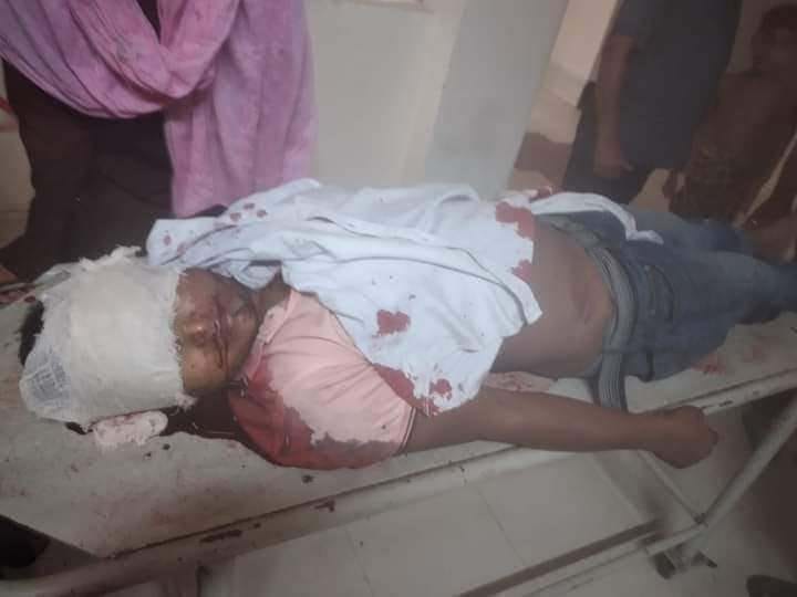 সীতাকুণ্ড হাইওয়ে পুলিশের ধাওয়ায় পালাতে গিয়ে লড়ির চাপায় সিএনজি চালক নিহত