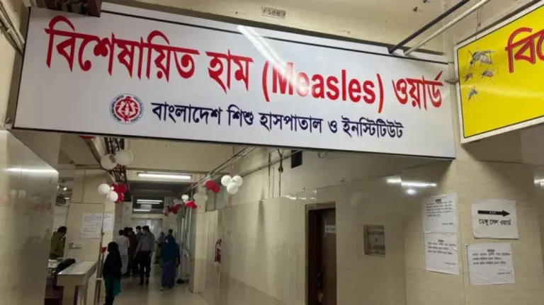 হাম ও হামের উপসর্গে মৃত্যু ৮০০ ছাড়ালো